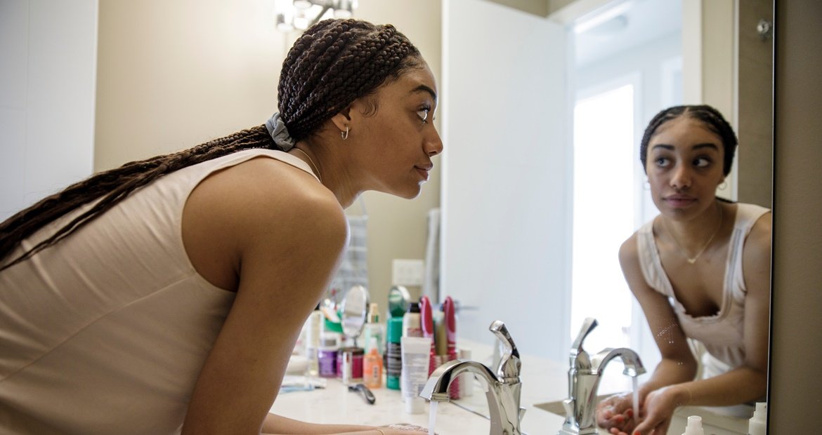 Adolescente realiza uma lavagem facial, passo importante para cuidar da pele após remover o adesivo para espinhas.